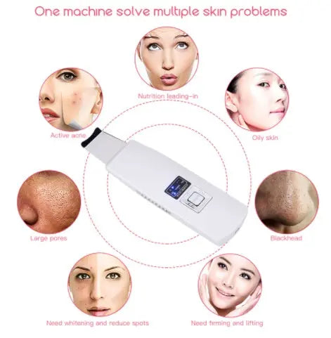 Ultrasonic Skin Scrubber | Blackhead Removal Tool | Sandy's Boutique