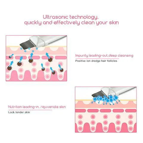 Ultrasonic Skin Scrubber | Blackhead Removal Tool | Sandy's Boutique