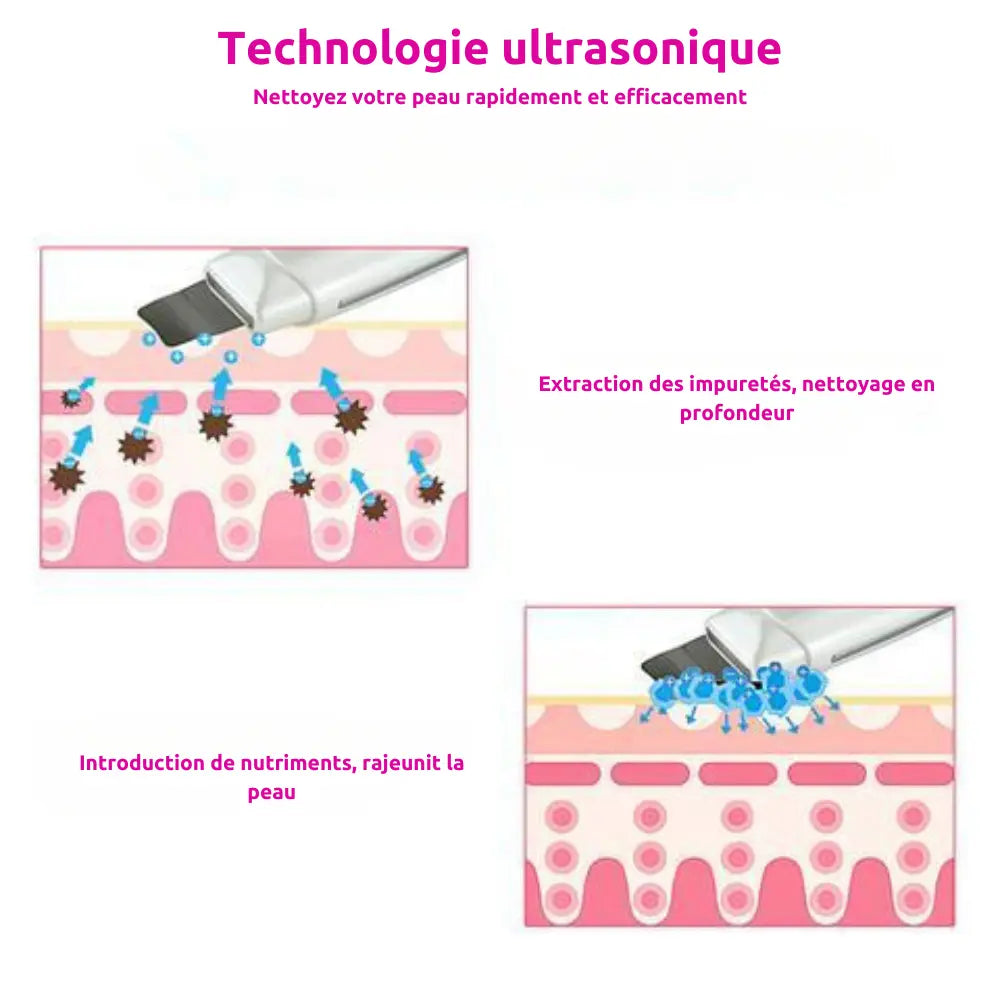 USB Skin Scrubber | Ultrasonic Skin Cleanser | Sandy's Boutique