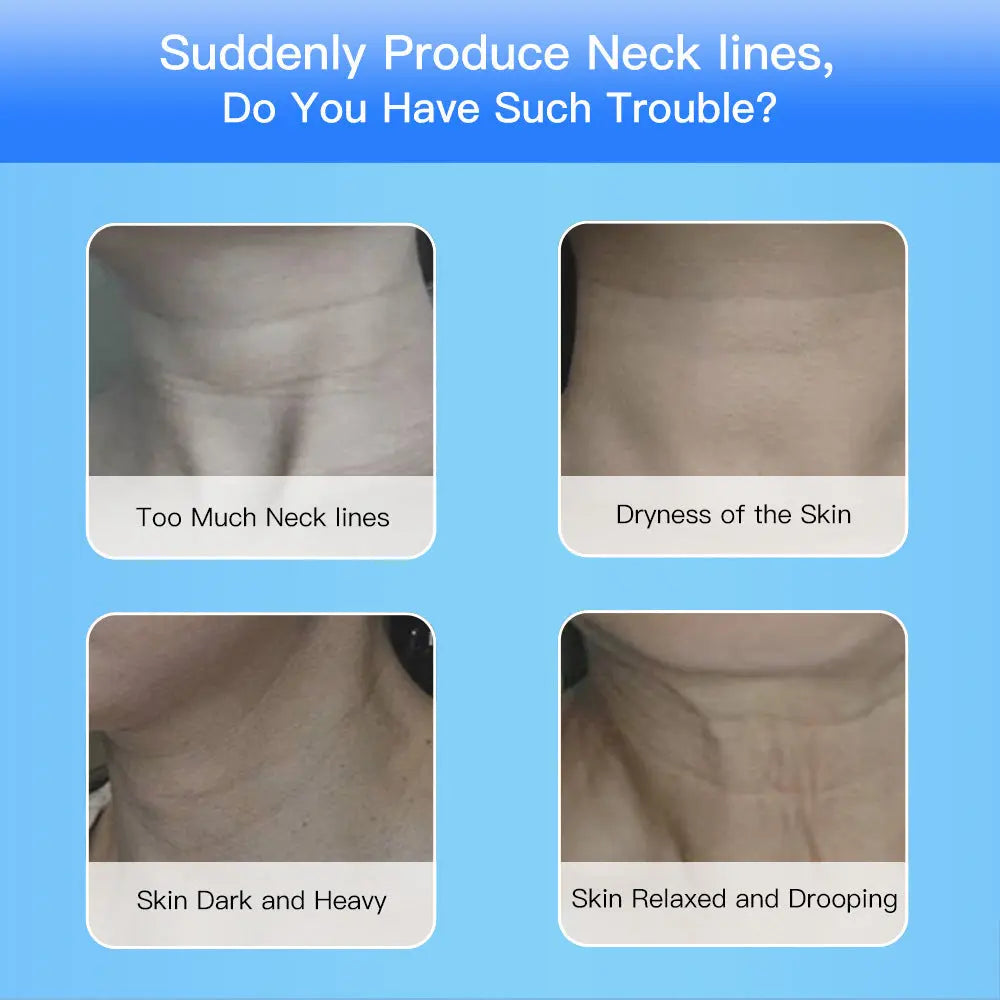 Neck Lifting Device | Anti-Aging Beauty Device | Sandy's Boutique